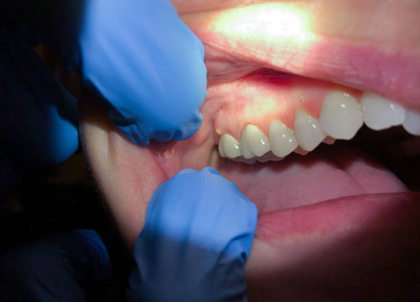 Best Walk-In Emergency Dentist in Lincoln Heights, OH