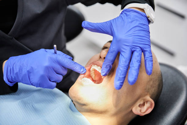 Best Emergency Broken Tooth Repair in Lincoln Heights, OH